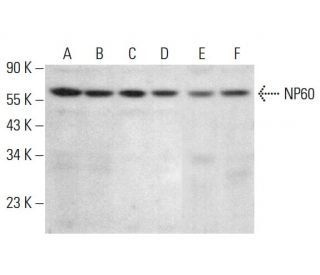 NP60 Antibody (D-10) - Western Blotting - Image 382078The Double Nickase Plasmid features a U6 promoter for sgRNA expression, a 20 nt targeting sequence, and a gRNA scaffold to guide Cas9n. It includes a CBh promoter for Cas9n (D10A) and puromycin resistance, GFP for transfection verification, and nuclear localization signals (NLS). The 2A peptide allows co-expression of Cas9n and Puro from a single promoter, enabling precise genome editing with reduced off-target effects.