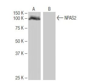 NPAS2 Antibody (FT-68) - Western Blotting - Image 65018SAM Transcription Activation: SAM system utilizing dCas9-VP64, MS2-P65-HSF1, and sgRNA for precise gene transcription activation.