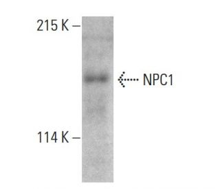 NPC1 Antibody (G-1) - Western Blotting - Image 387371The Double Nickase Plasmid features a U6 promoter for sgRNA expression, a 20 nt targeting sequence, and a gRNA scaffold to guide Cas9n. It includes a CBh promoter for Cas9n (D10A) and puromycin resistance, GFP for transfection verification, and nuclear localization signals (NLS). The 2A peptide allows co-expression of Cas9n and Puro from a single promoter, enabling precise genome editing with reduced off-target effects.