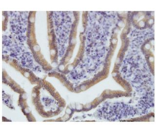 immunohistochemistry image from recommended NPR-B (1E4) monoclonal antibody replacement. Image 351745