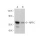 Cet anticorps polyclonal n'est plus commercialisé. Voir l'anticorps monoclonal <a href="npr-c-antibody-e-5">NPR-C (E-5)</a> que nous recommandons (données d'échantillonnage indiquées). western blotting image from recommended NPR-C (E-5) monoclonal antibody replacement. Image 358652