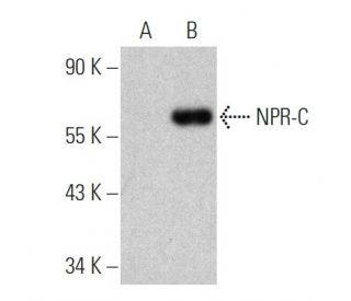 NPR-C Antibody (B-9) - Western Blotting - Image 360605Each CRISPR/Cas9 Knockout (KO) Plasmid product consists of a pool of 3 plasmids designed to ensure identification and cleavage of a specific gene for maximum knockout efficiency. Each plasmid encodes a unique 20 nt sequence derived from the GeCKO (v2) library. 