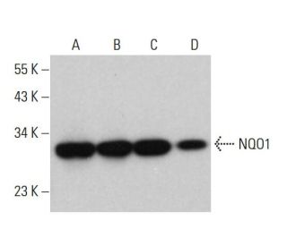 western blotting image from recommended NQO1 (A180) monoclonal antibody replacement. Image 376095