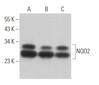 western blotting image from recommended NQO2 (A-5) monoclonal antibody replacement. Image 363080