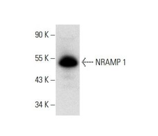NRAMP 1 Antibody (E-2) - Western Blotting - Image 300605Each CRISPR/Cas9 Knockout (KO) Plasmid product consists of a pool of 3 plasmids designed to ensure identification and cleavage of a specific gene for maximum knockout efficiency. Each plasmid encodes a unique 20 nt sequence derived from the GeCKO (v2) library.