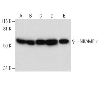 western blotting image from recommended NRAMP 2 (G-5) monoclonal antibody replacement. Image 300478