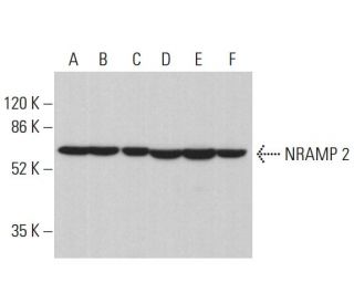 NRAMP 2 Antibody (G-5) - Western Blotting - Image 377006 