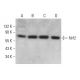This polyclonal antibody has been discontinued. See our recommended <a href="nrf2-antibody-a-10">Nrf2 (A-10)</a> monoclonal antibody (sample data shown). western blotting image from recommended Nrf2 (A-10) monoclonal antibody replacement. Image 376608