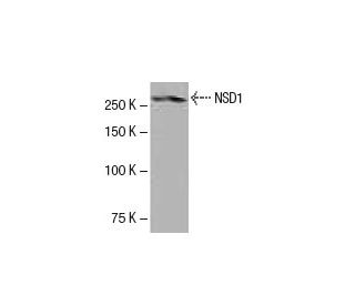 NSD1 Antibody (K47) - Western Blotting - Image 53970Each CRISPR/Cas9 Knockout (KO) Plasmid product consists of a pool of 3 plasmids designed to ensure identification and cleavage of a specific gene for maximum knockout efficiency. Each plasmid encodes a unique 20 nt sequence derived from the GeCKO (v2) library.