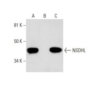 NSDHL Antibody (B-5) - Western Blotting - Image 291880 