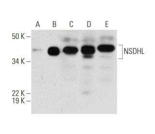NSDHL Antibody (D-11) - Western Blotting - Image 290966 