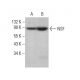NSF Antibody (B-9) - Western Blotting - Image 383774
