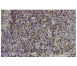 NSP3 Antibody (J-16.1) - Immunohistochemistry - Image 36162 