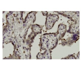 NT5C2 Antibody (FF-12) - Immunohistochemistry - Image 35957 
