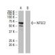 NT5C2 Antibody (FF-12) - Western Blotting - Image 33650