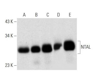 NTAL Antibody (F-9) - Western Blotting - Image 309585 