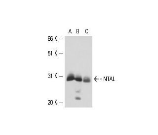 NTAL Antibody (NAP-07) - Western Blotting - Image 16138