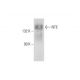 NTE Antibody (G-4) - Western Blotting - Image 128766