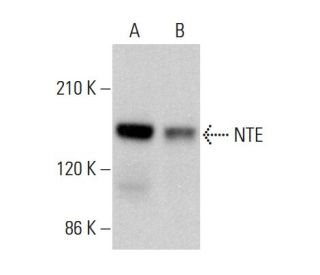 NTE Antibody (G-4) - Western Blotting - Image 375512 