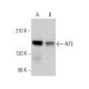 NTE Antibody (G-4) - Western Blotting - Image 375512 