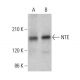 NTE Antibody (G-4) - Western Blotting - Image 375517 