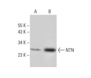 western blotting image from recommended NTN (D-10) monoclonal antibody replacement. Image 296932