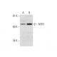 NTR1 Antibody (G-9) - Western Blotting - Image 292965
