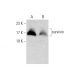 Cdk2 Inhibitor IV, NU6140: sc-202531. Western blot analysis of survivin expression in untreated (A) and Cdk2 Inhibitor IV,