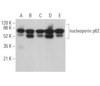 nucleoporin p62 Antibody (2A11) - Western Blotting - Image 361640 