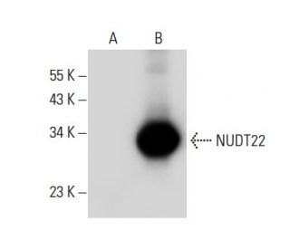 NUDT22 Antibody (B-11) - Western Blotting - Image 308033