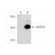 NUDT22 Antibody (B-2) - Western Blotting - Image 295787