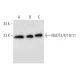 NUDT3/4/10/11 Antibody (B-8) - Western Blotting - Image 309487 