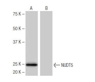 NUDT5 Antibody (FT-98) - Western Blotting - Image 65019