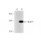 NUDT7 Antibody (E-9) - Western Blotting - Image 290959