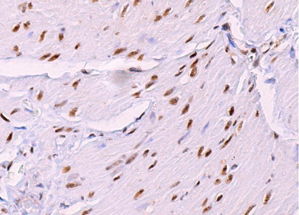 NuMA Antibody (F-11) | SCBT - Santa Cruz Biotechnology