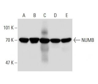 western blotting image from recommended NUMB (48) monoclonal antibody replacement. Image 144680