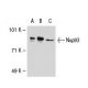 Nup93 Antibody (3332C2a) - Western Blotting - Image 31016 