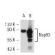 Nup93 Antibody (3332C2a) - Western Blotting - Image 50362 
