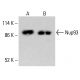 Nup93 Antibody (F-2) - Western Blotting - Image 414572