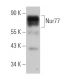 Nur77 Antibody (E-6) - Western Blotting - Image 361137
