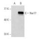 western blotting image from recommended Nur77 (C-5) monoclonal antibody replacement. Image 356964