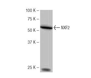 NXF2 Antibody (NB-B46) - Western Blotting - Image 65021