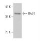 OAS1 Antibody (F-3) - Western Blotting - Image 371968