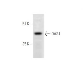 western blotting image from recommended OAS1 (F-3) monoclonal antibody replacement. Image 344604