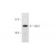 western blotting image from recommended OAS1 (F-3) monoclonal antibody replacement. Image 344604