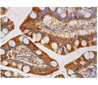 OAS2 Antibody (G-9) - Immunohistochemistry - Image 160000 
