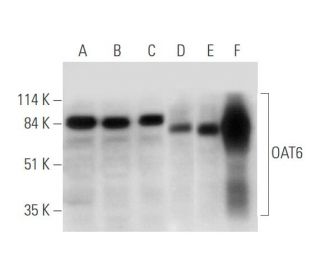 OAT6 Antibody (D-5) - Western Blotting - Image 333646