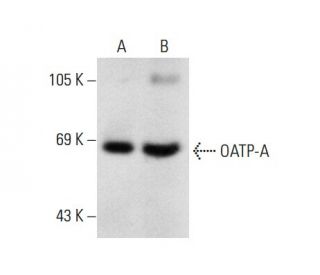 OATP-A Antibody (E-7) - Western Blotting - Image 137929 