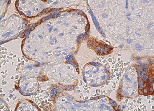 Anti-Ob Antibody (F-3) | SCBT - Santa Cruz Biotechnology