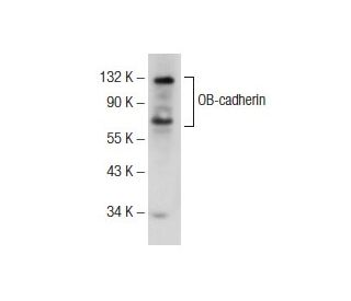 western blotting image from recommended OB-cadherin (F-3) monoclonal antibody replacement. Image 145650